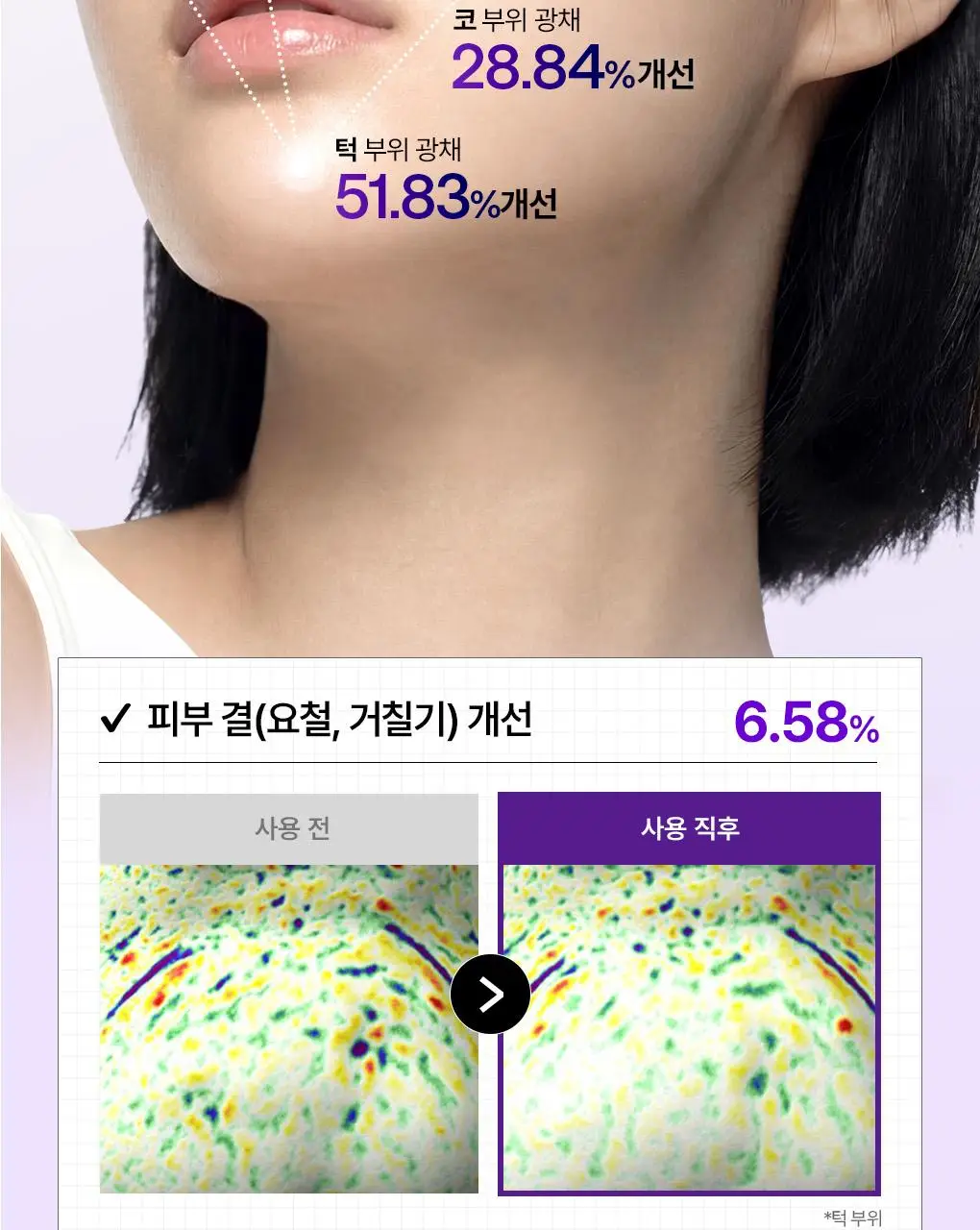 [업그레이드 모공탄력세럼] 메디힐 PDRN 더마 세럼 50+50mL 기획 상세페이지 19